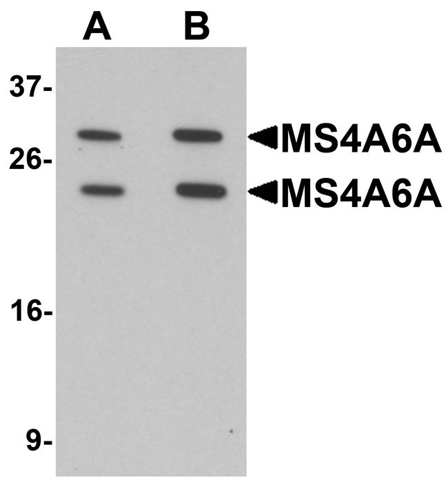 MS4A6A / MS4A Antibody - Western blot analysis of MS4A6A in 293 cell lysate with MS4A6A antibody at (A) 1 and (B) 2 ug/ml.