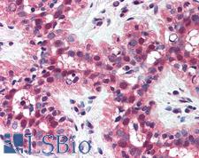 MSH2 Antibody - Anti-MSH2 antibody IHC of human breast. Immunohistochemistry of formalin-fixed, paraffin-embedded tissue after heat-induced antigen retrieval. Antibody concentration 5 ug/ml.
