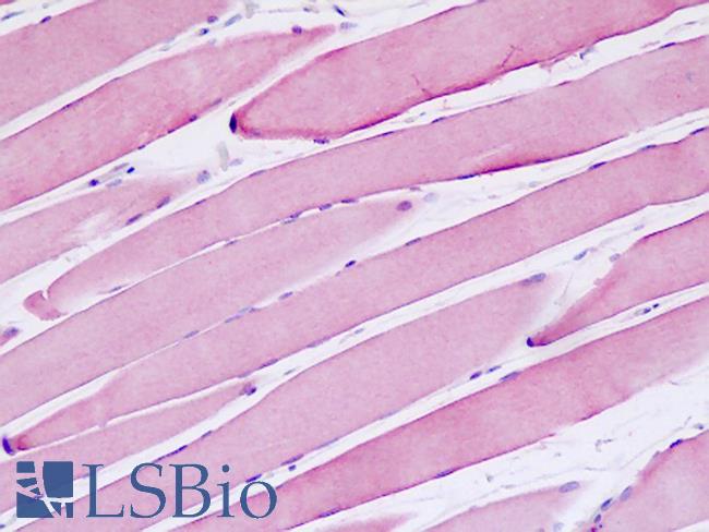 MSH3 Antibody - Anti-MRP1 / MSH3 antibody IHC staining of human skeletal muscle. Immunohistochemistry of formalin-fixed, paraffin-embedded tissue after heat-induced antigen retrieval.