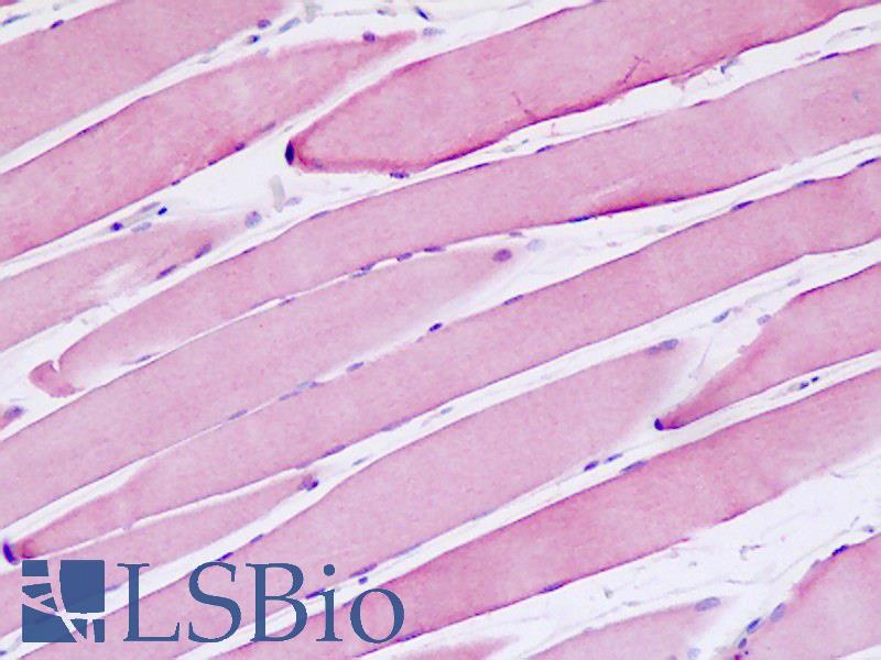 MSH3 Antibody - Anti-MRP1 / MSH3 antibody IHC staining of human skeletal muscle. Immunohistochemistry of formalin-fixed, paraffin-embedded tissue after heat-induced antigen retrieval.