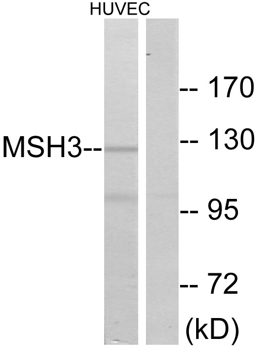 MSH3 Antibody - Western blot analysis of lysates from HUVEC cells, using MSH3 Antibody. The lane on the right is blocked with the synthesized peptide.