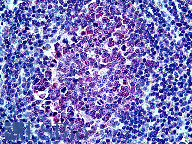 MSH6 Antibody - Anti-MSH6 antibody IHC of human tonsil. Immunohistochemistry of formalin-fixed, paraffin-embedded tissue after heat-induced antigen retrieval. Antibody concentration 5 ug/ml.