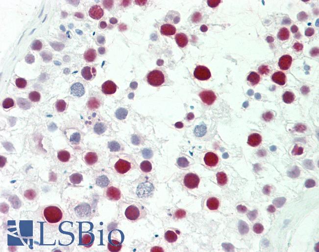 MSH6 Antibody - Anti-MSH6 antibody IHC staining of human testis. Immunohistochemistry of formalin-fixed, paraffin-embedded tissue after heat-induced antigen retrieval. Antibody dilution 1:50.