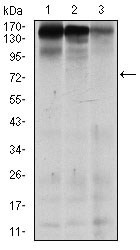 MSH6 Antibody - Western blot using MSH6 mouse monoclonal antibody against MCF-7 (1), HEK293 (2), and HCT116 (3) cell lysate.