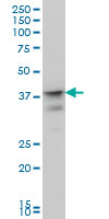 MSI1 / Musashi 1 Antibody - MSI1 monoclonal antibody clone 3F2 Western blot of MSI1 expression in IMR-32.
