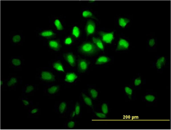 MSI1 / Musashi 1 Antibody - Immunofluorescence of monoclonal antibody to MSI1 on HeLa cell (antibody concentration 10 ug/ml).
