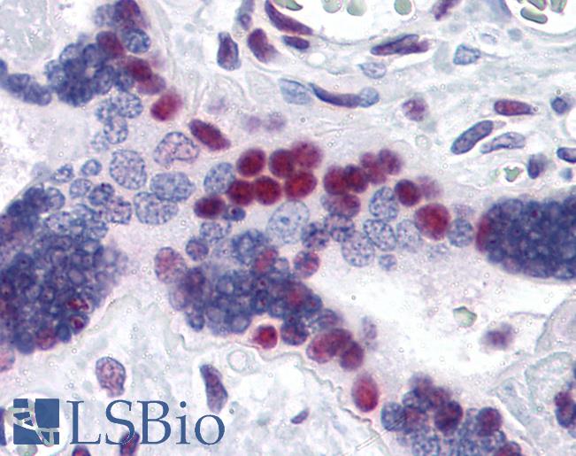 MSI1 / Musashi 1 Antibody - Anti-MSI1 antibody IHC of human placenta. Immunohistochemistry of formalin-fixed, paraffin-embedded tissue after heat-induced antigen retrieval. Antibody concentration 10 ug/ml.
