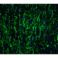 MSI2 Antibody - Immunofluorescence of MSI2 in mouse brain tissue with MSI2 Antibodyat 20 µg/mL.Green: MSI2 antibody  Red: Phylloidin staining Blue: DAPI staining