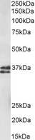 MSI2 Antibody - Antibody (1µg/ml) staining of fetal Mouse Brain lysate (35µg protein in RIPA buffer). Primary incubation was 1 hour. Detected by chemiluminescence.