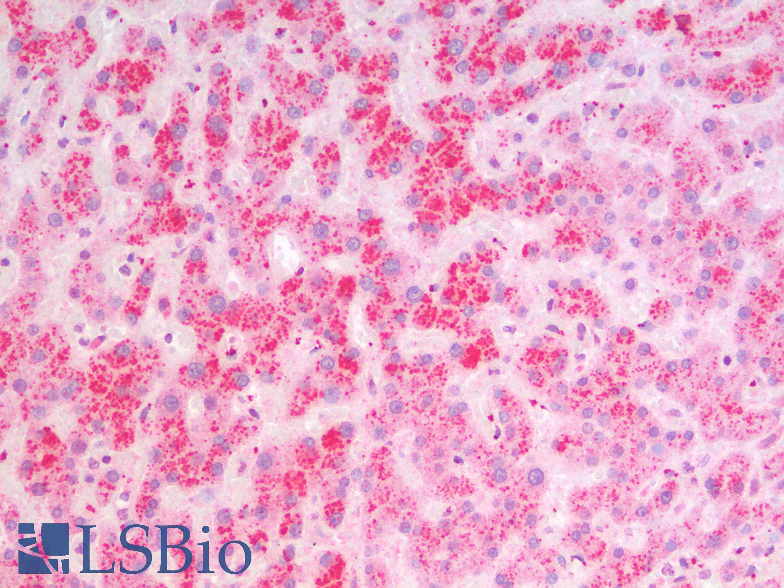 MSI2 Antibody - Human Liver: Formalin-Fixed, Paraffin-Embedded (FFPE)