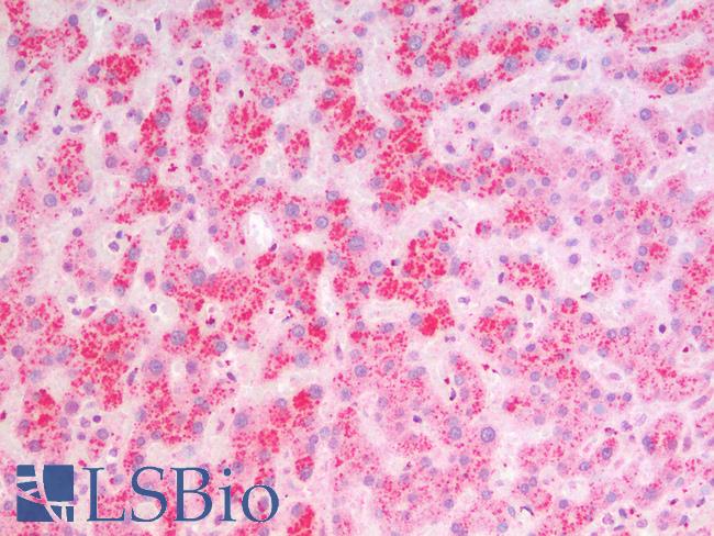 MSI2 Antibody - Human Liver: Formalin-Fixed, Paraffin-Embedded (FFPE)