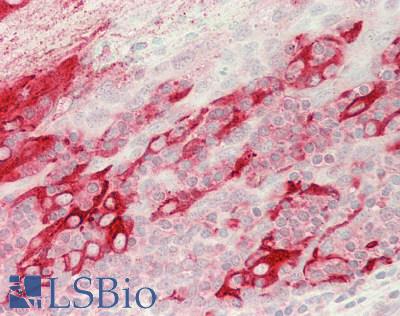 MSLN / Mesothelin Antibody - Human Tonsil, Epithelium: Formalin-Fixed, Paraffin-Embedded (FFPE)