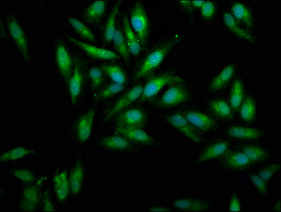 MSLN / Mesothelin Antibody - Immunofluorescence staining of Hela cells with MSLN Antibody at 1:100, counter-stained with DAPI. The cells were fixed in 4% formaldehyde, permeabilized using 0.2% Triton X-100 and blocked in 10% normal Goat Serum. The cells were then incubated with the antibody overnight at 4°C. The secondary antibody was Alexa Fluor 488-congugated AffiniPure Goat Anti-Rabbit IgG(H+L).