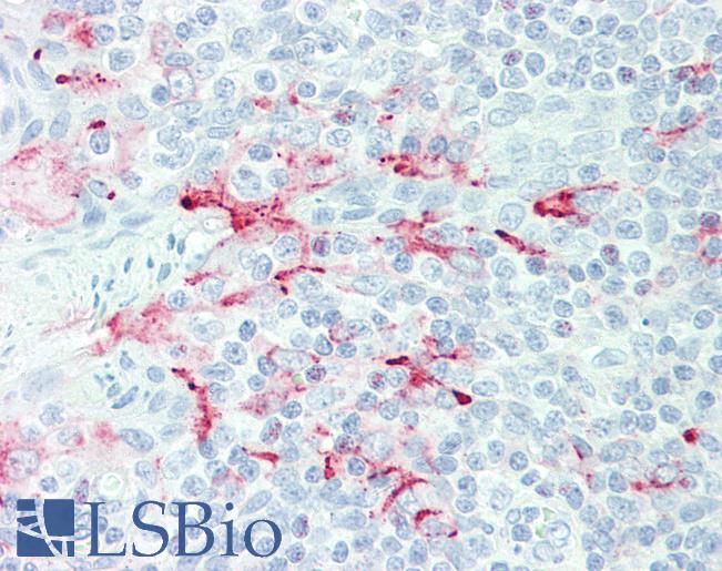 MSLN / Mesothelin Antibody - Anti-MSLN / Mesothelin antibody IHC staining of human tonsil. Immunohistochemistry of formalin-fixed, paraffin-embedded tissue after heat-induced antigen retrieval. Antibody concentration 15 ug/ml.