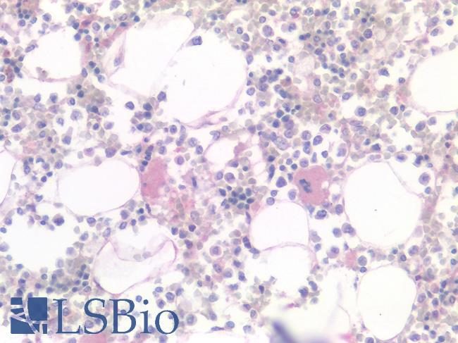 MSLN / Mesothelin Antibody - Human Bone Marrow, Megakaryocytes: Formalin-Fixed, Paraffin-Embedded (FFPE)