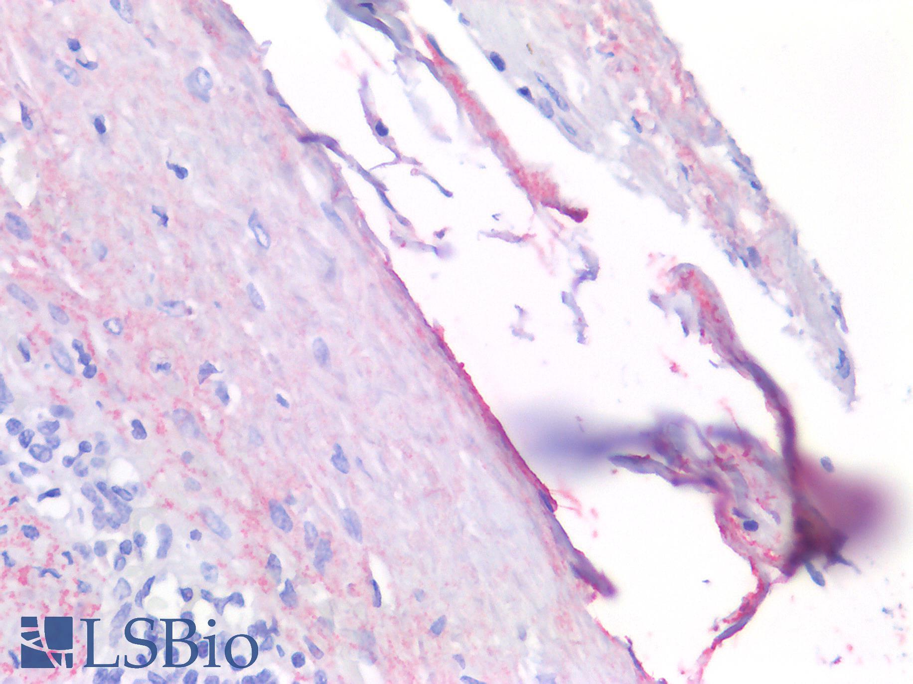 MSLN / Mesothelin Antibody - Human Spleen, Mesothelial Cells: Formalin-Fixed, Paraffin-Embedded (FFPE)