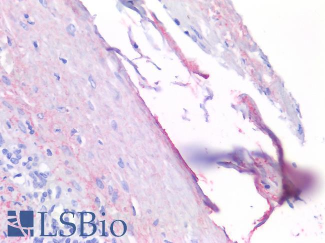 MSLN / Mesothelin Antibody - Human Spleen, Mesothelial Cells: Formalin-Fixed, Paraffin-Embedded (FFPE)