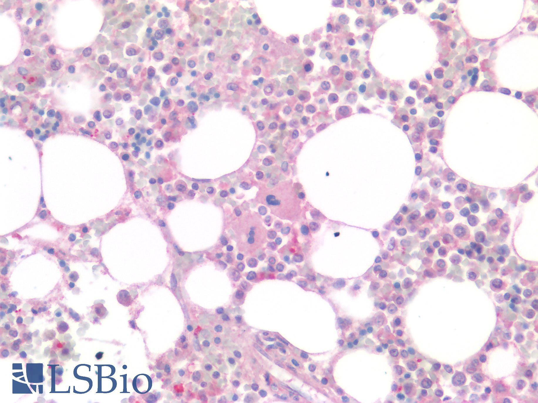 MSLN / Mesothelin Antibody - Human Bone Marrow, Megakaryocytes: Formalin-Fixed, Paraffin-Embedded (FFPE)