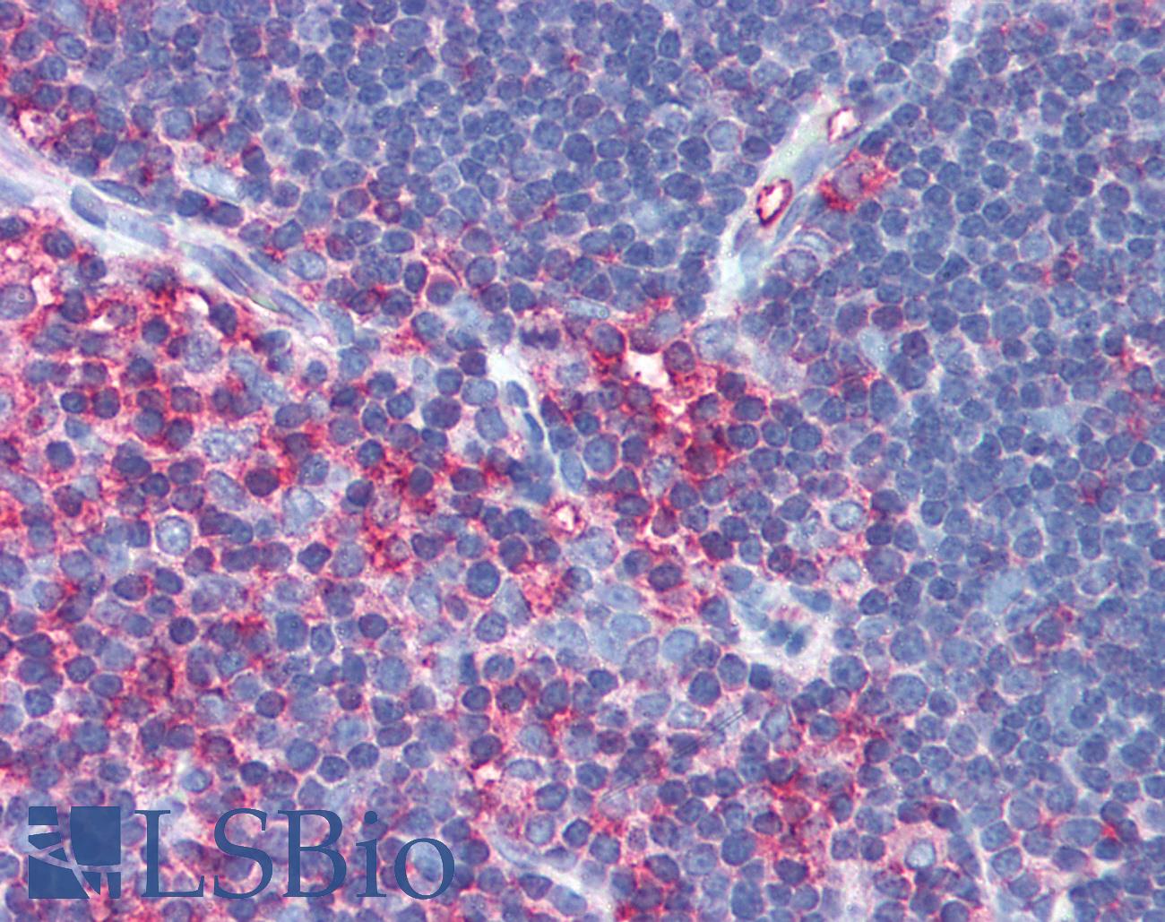 MSN / Moesin Antibody - Anti-MSN / Moesin antibody IHC of human thymus. Immunohistochemistry of formalin-fixed, paraffin-embedded tissue after heat-induced antigen retrieval. Antibody concentration 5 ug/ml.