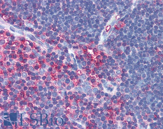 MSN / Moesin Antibody - Anti-MSN / Moesin antibody IHC of human thymus. Immunohistochemistry of formalin-fixed, paraffin-embedded tissue after heat-induced antigen retrieval. Antibody concentration 5 ug/ml.