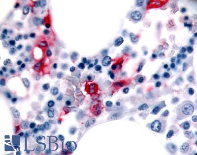 MST1R / RON Antibody - Bone marrow