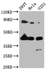 MSTN / GDF8 / Myostatin Antibody - Western Blot Positive WB detected in: 293T whole cell lysate, Hela whole cell lysate, U251 whole cell lysate All lanes: MSTN antibody at 4µg/ml Secondary Goat polyclonal to rabbit IgG at 1/50000 dilution Predicted band size: 43 kDa Observed band size: 43 kDa