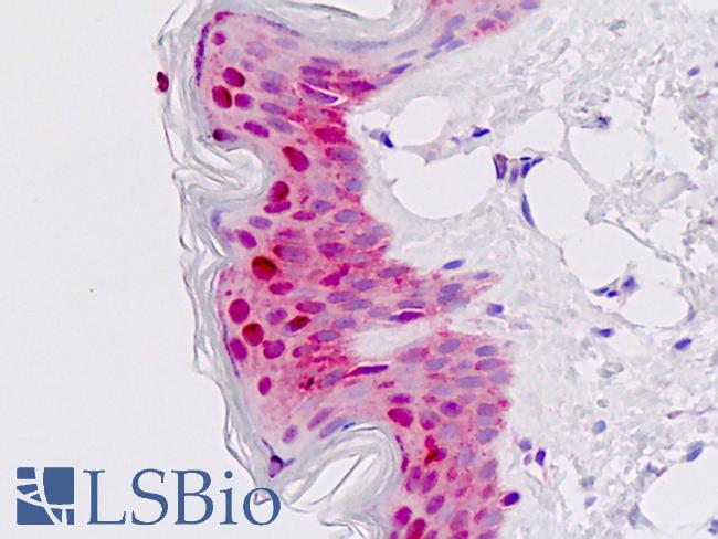 MSX2 / MSH Antibody - Human Skin: Formalin-Fixed, Paraffin-Embedded (FFPE)