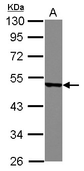 MSY2 / YBX2 Antibody - Sample (30 ug of whole cell lysate) A: IMR32 10% SDS PAGE YBX2 antibody diluted at 1:1000
