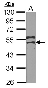 MSY2 / YBX2 Antibody - Sample (50 ug of whole cell lysate) A: mouse testis 10% SDS PAGE YBX2 antibody diluted at 1:1000
