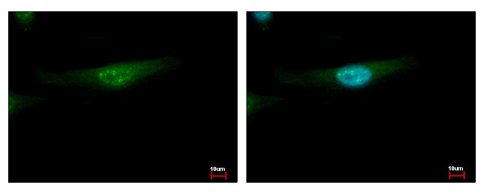 MSY2 / YBX2 Antibody - YBX2 antibody [N2C2], Internal detects YBX2 protein at cytoplasm and nucleus by immunofluorescent analysis. HeLa cells were fixed in ice-cold MeOH for 5 min. YBX2 protein stained by YBX2 antibody [N2C2], Internal diluted at 1:500.