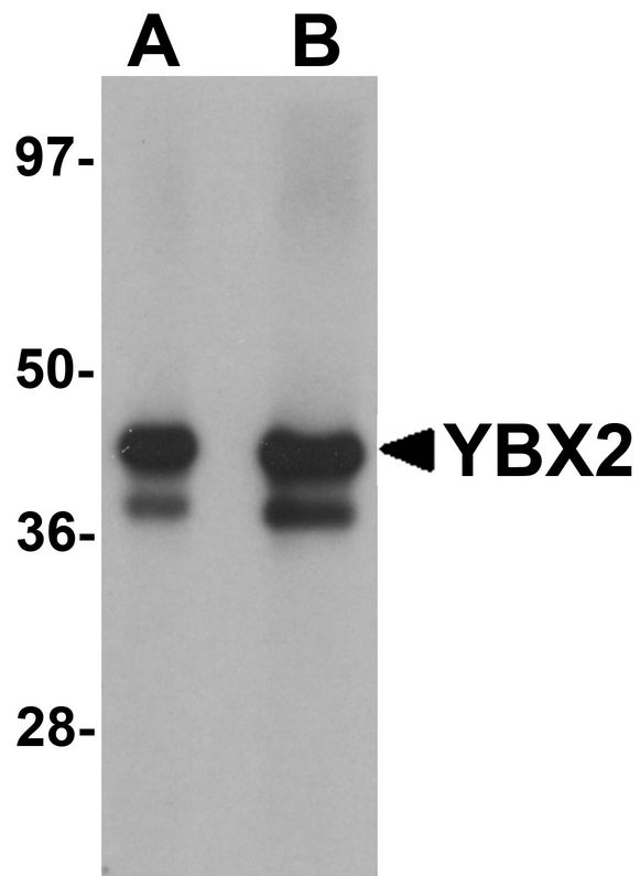 MSY2 / YBX2 Antibody - Western blot analysis of YBX2 in human testis tissue lysate with YBX2 antibody at (A) 1 and (B) 2 ug/ml.