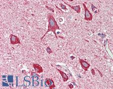 MT-CO2 Antibody - Human Brain, Cortex: Formalin-Fixed, Paraffin-Embedded (FFPE), at a dilution of 1:100.