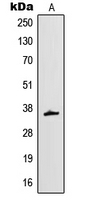 MT-ND1 Antibody - Western blot analysis of MT-ND1 expression in HeLa (A) whole cell lysates.