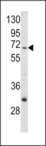 MT-ND5 Antibody - Western blot of ND5 Antibody in CEM cell line lysates (35 ug/lane). ND5 (arrow) was detected using the purified antibody.