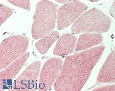 MT-ND5 Antibody - Human Skeletal Muscle: Formalin-Fixed, Paraffin-Embedded (FFPE)