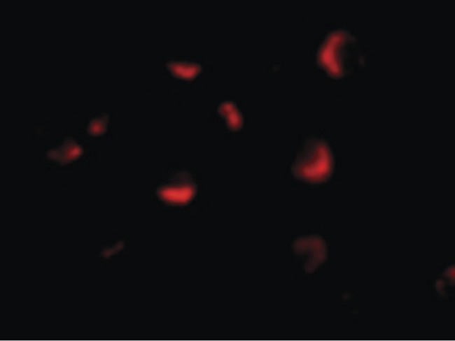 MTA2 Antibody - Immunofluorescence of PID in HeLa cells with PID antibody at 10 ug/ml.