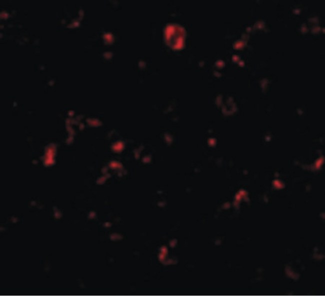 MTBP / Mdm2-Binding Protein Antibody - Immunofluorescence of MTBP in K562 cells with MTBP antibody at 20 ug/ml.