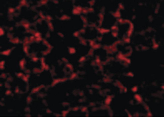 MTCH2 Antibody - Immunofluorescence of MTCH2 in Mouse Kidney cells with MTCH2 antibody at 20 ug/ml.