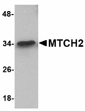 MTCH2 Antibody - Western blot of MTCH2 in 293 cell lysate with MTCH2 antibody at 1 ug/ml. 