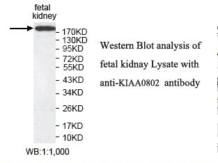 MTCL1 / SOGA2 Antibody