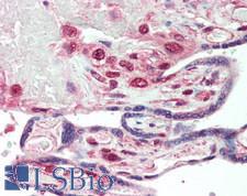 MTDH / Metadherin Antibody - Human Placenta: Formalin-Fixed, Paraffin-Embedded (FFPE), at a concentration of 5 ug/ml.