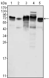 MTDH / Metadherin Antibody - Western blot using Metadherin mouse monoclonal antibody against K562 (1), SKBR-3 (2), T47D (3), HeLa (4) and MCF-7 (5) cell lysate.