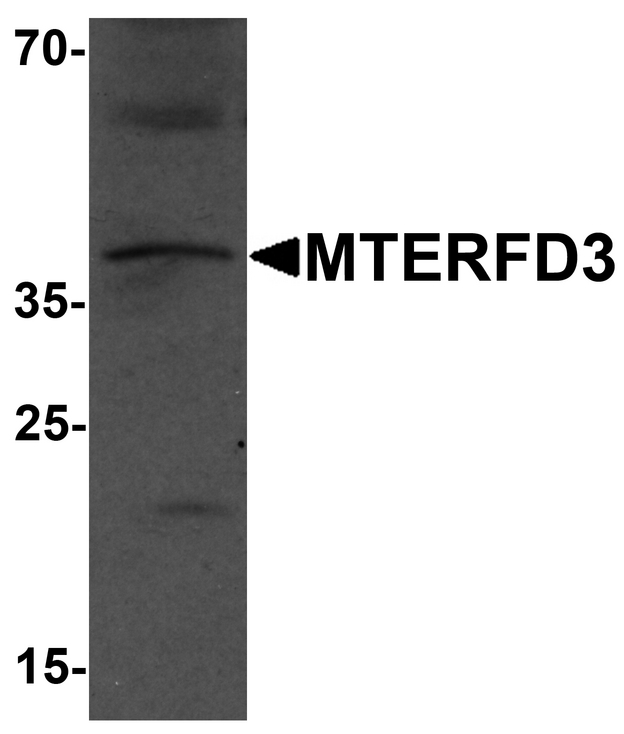 MTERF2 / MTERFD3 Antibody - Western blot analysis of MTERFD3 in human testis tissue lysate with MTERFD3 antibody at 1 ug/ml.