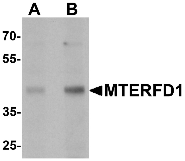 MTERF3 / MTERFD1 Antibody - Western blot analysis of MTERFD1 in 3T3 cell lysate with MTERFD1 antibody at (A) 1 and (B) 2 ug/ml.