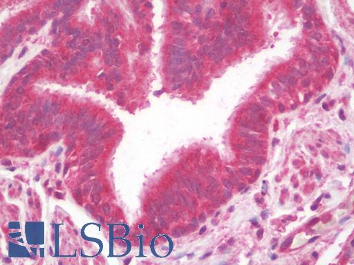 MTERF3 / MTERFD1 Antibody - Anti-MTERFD1 antibody IHC staining of human lung. Immunohistochemistry of formalin-fixed, paraffin-embedded tissue after heat-induced antigen retrieval. Antibody concentration 10 ug/ml.