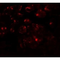 MTERF3 / MTERFD1 Antibody - Immunofluorescence of MTERFD1 in 3T3 cells with MTERFD1 antibody at 20 µg/mL.