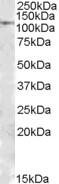 MTHFD1 Antibody - Antibody (1 ug/ml) staining of Human Substantia Nigra lysate (35 ug protein in RIPA buffer). Primary incubation was 1 hour. Detected by chemiluminescence.
