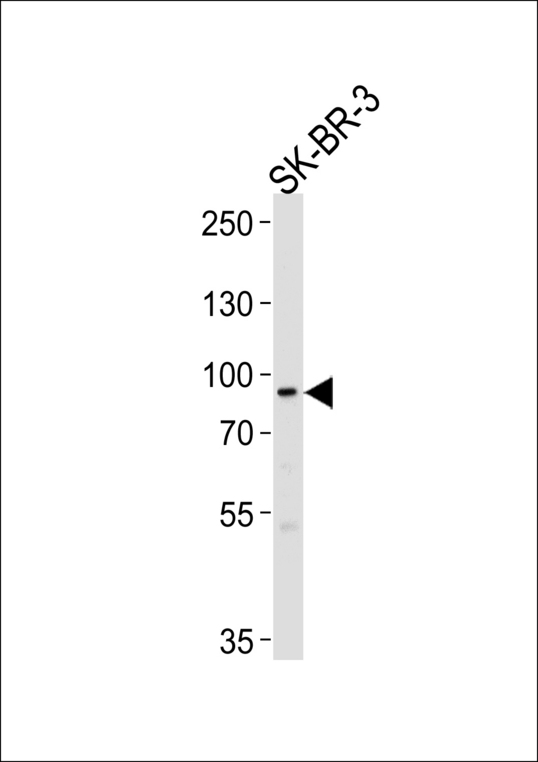 MTIF2 Antibody - Western blot of lysate from SK-BR-3 cell line, using MTIF2 Antibody. Antibody was diluted at 1:1000 at each lane. A goat anti-rabbit IgG H&L (HRP) at 1:5000 dilution was used as the secondary antibody. Lysate at 35ug per lane.