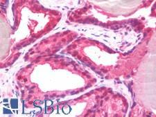 MTOR Antibody - Human Prostate: Formalin-Fixed, Paraffin-Embedded (FFPE)