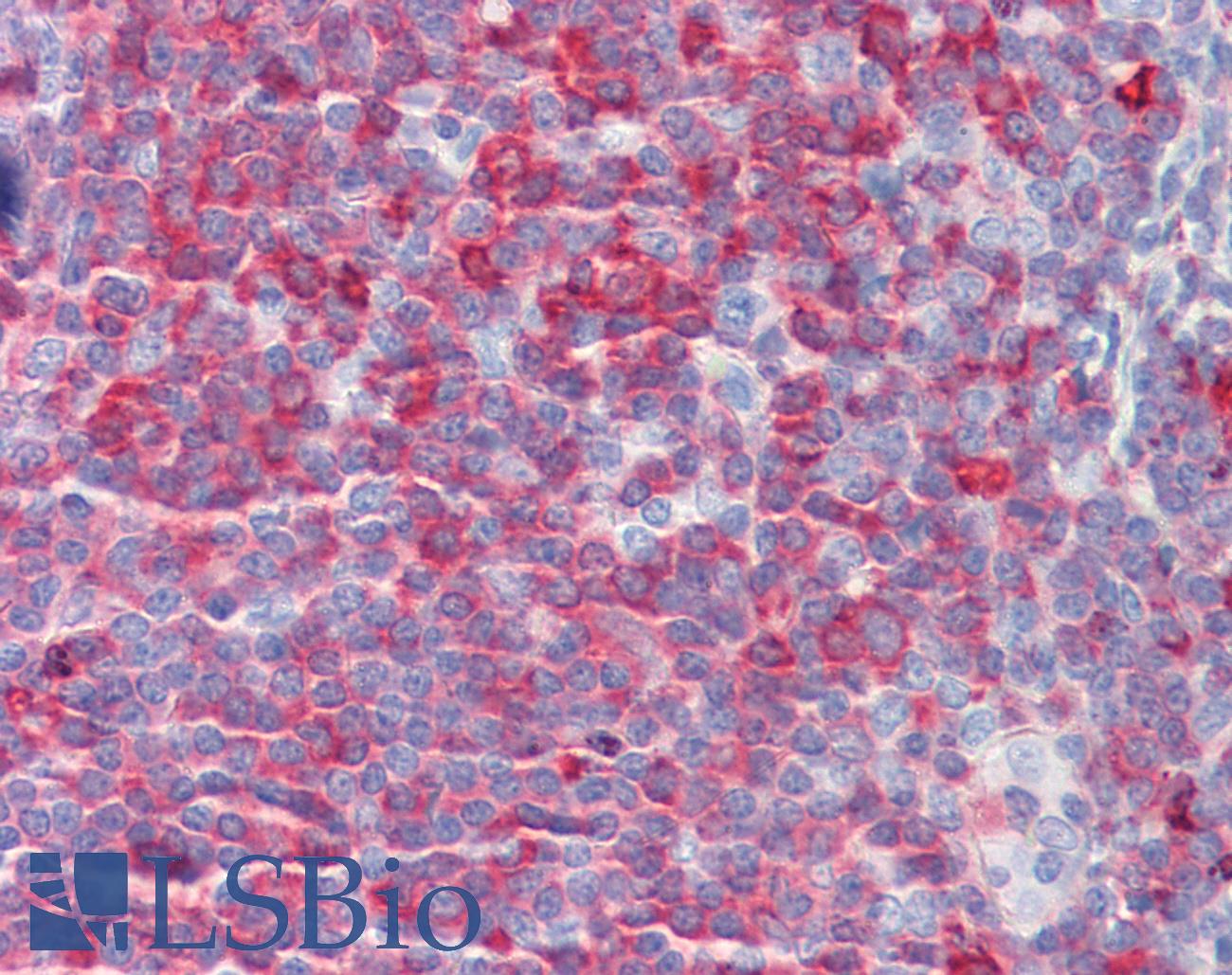 MTOR Antibody - Anti-MTOR antibody IHC staining of human tonsil. Immunohistochemistry of formalin-fixed, paraffin-embedded tissue after heat-induced antigen retrieval.